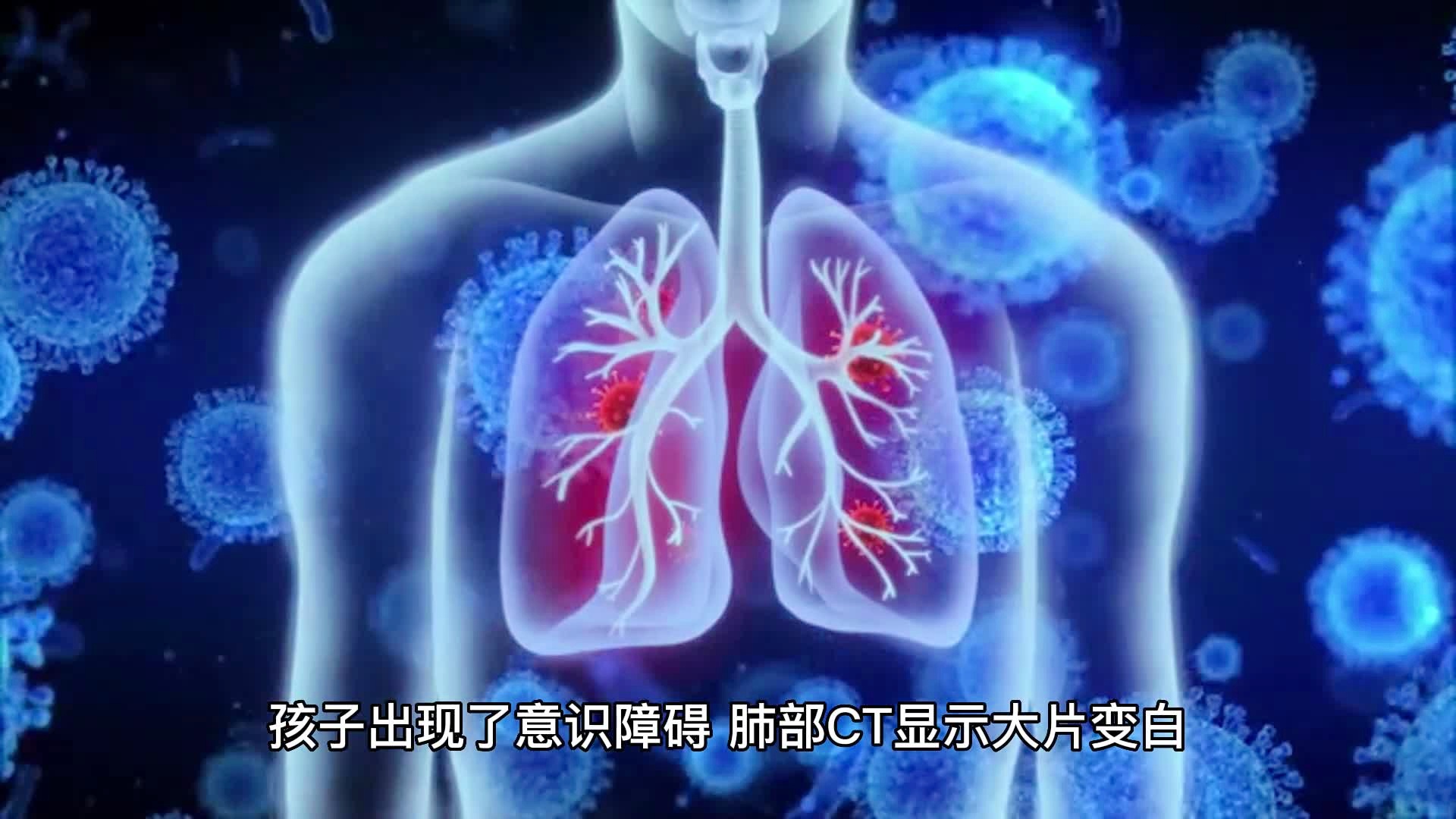 男子甲流后发烧一查竟成病毒性肺炎，警惕流感并发症_最佳精选