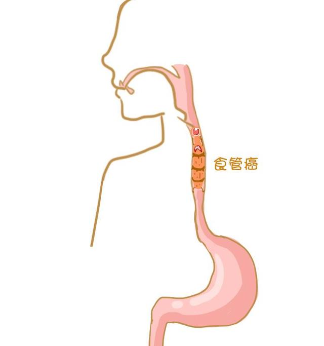 长期食用超65℃食物易患食道癌_动态词语解释落实