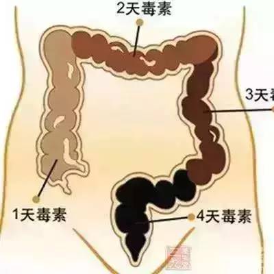 体内惊现2.73米绦虫，深度解析人体寄生虫感染_精密解答