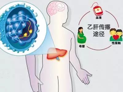 出现哪些症状代表甲流已很严重_知识解释