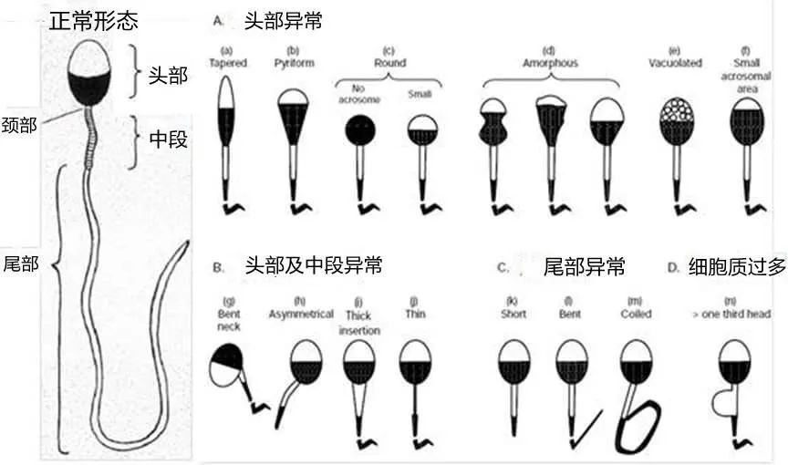 一、文章标题，警惕！27岁男子精子畸形率高达98%，揭示现代都市生活的隐形杀手_反馈记录和整理