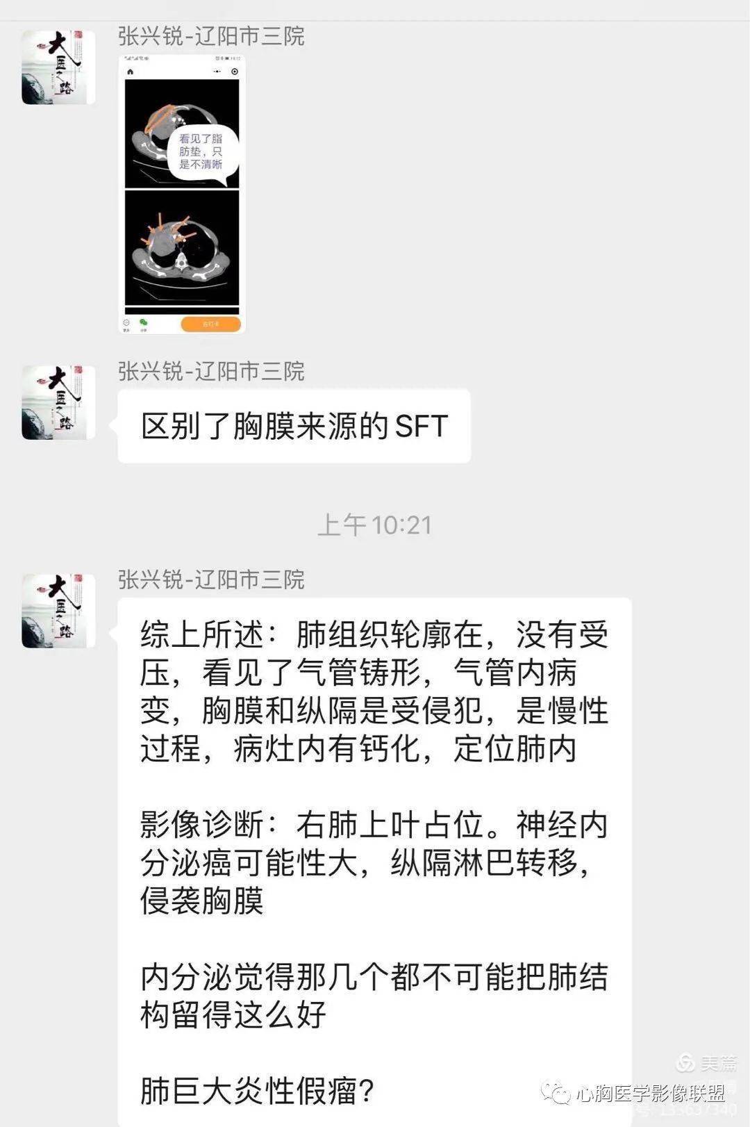 推荐，逆风而上，DeepSeek翻译展现超凡实力——他强任他强，清风拂山岗！_精选解释落实