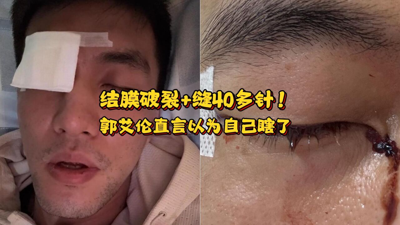 郭艾伦遭遇重大眼伤，结膜破碎缝针超40，运动生涯能否继续？_动态词语解释