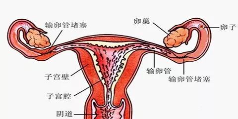 20年便秘终于解脱！腹中巨型结肠让医护人员震惊！_细化落实