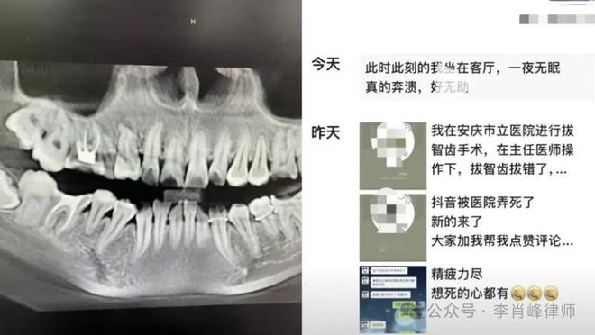 惊！女子疑因拔错牙绝望坠楼，医患纠纷背后真相令人心碎！_反馈实施和执行力